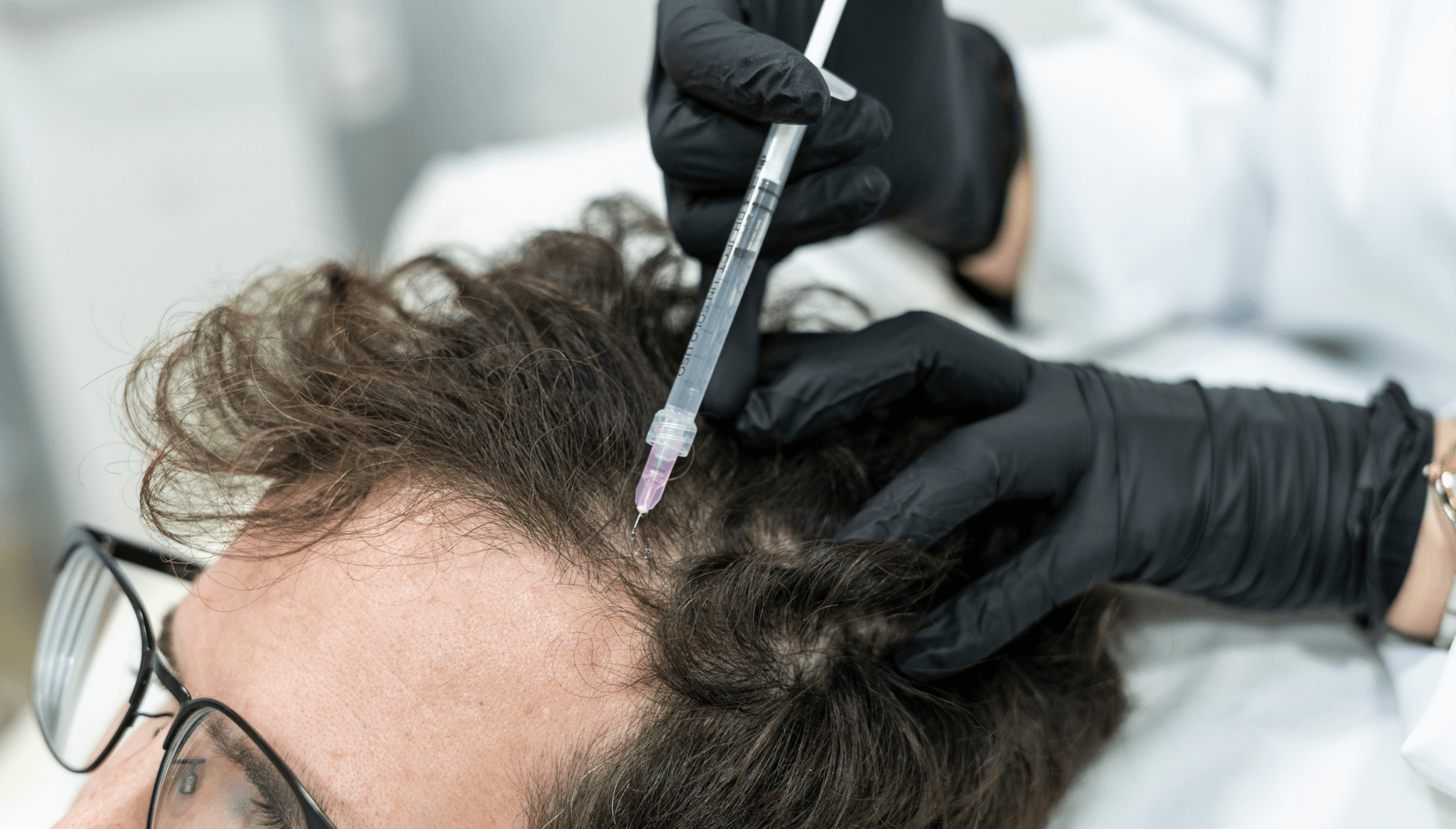 Resultado masculino - cabelo recuperado